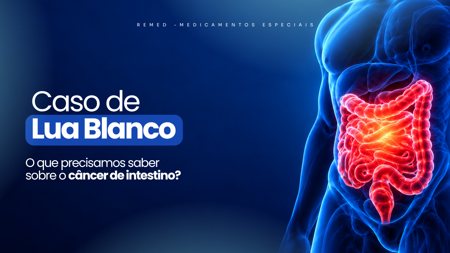 Leia mais sobre o artigo Lua Blanco e o câncer de intestino: sinais de alerta e tratamentos